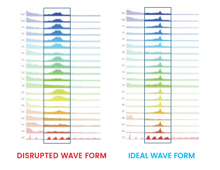 Comparison between disrupted and ideal wave forms